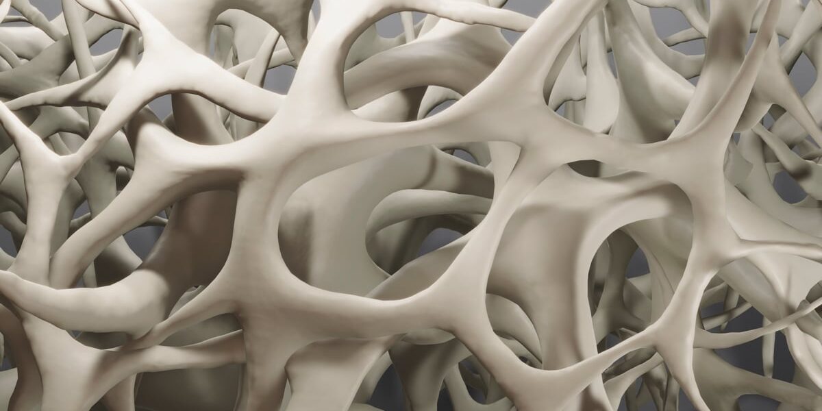 bone-density-closeup