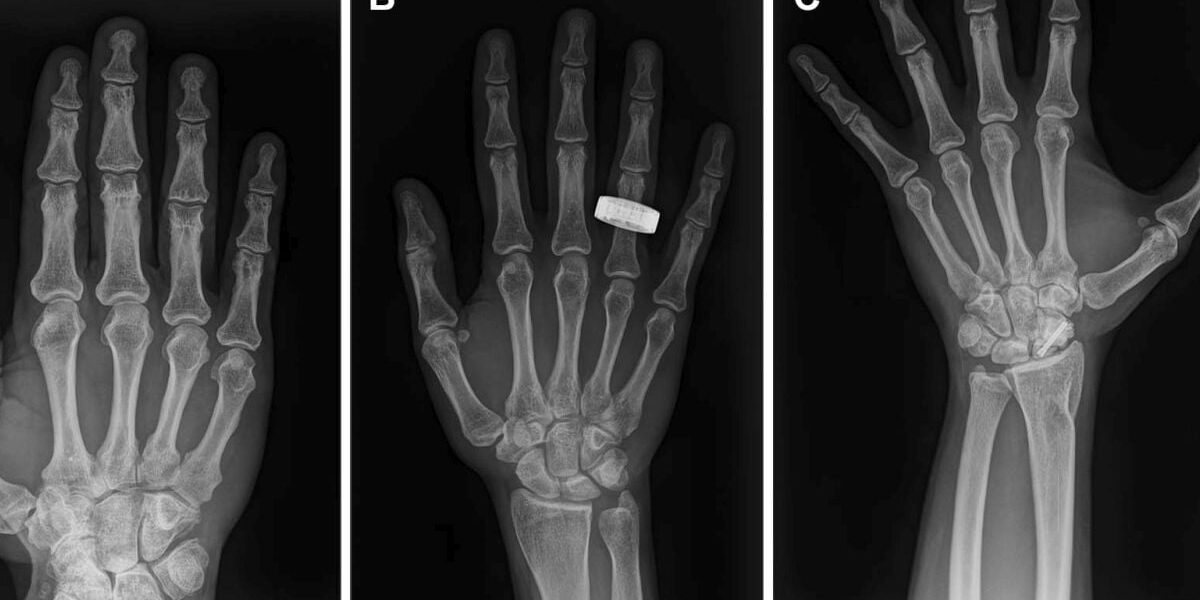 hand-x-rays