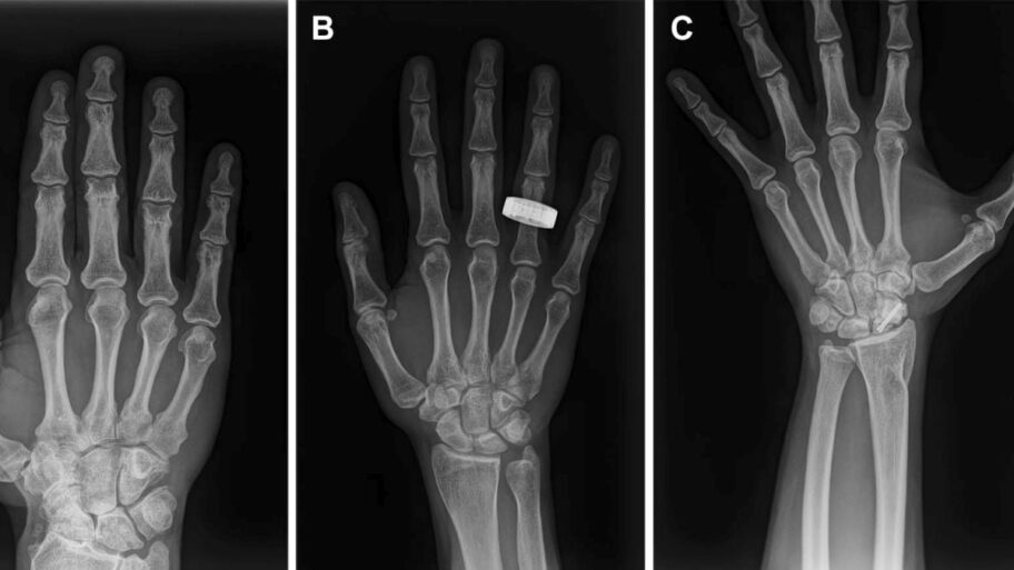 hand-x-rays