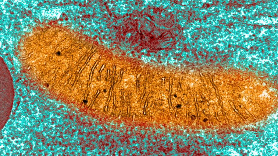 MitochondriaTEM