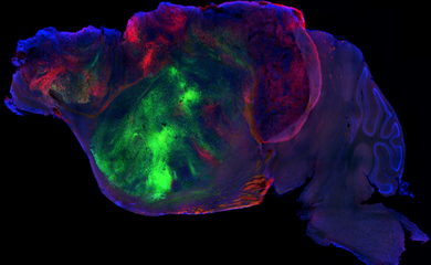 mouse-brain