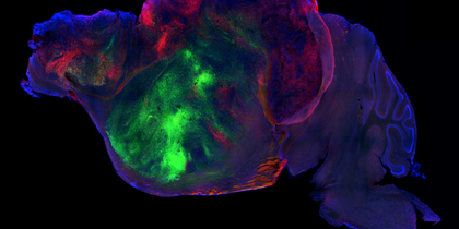 mouse-brain