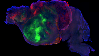 mouse-brain